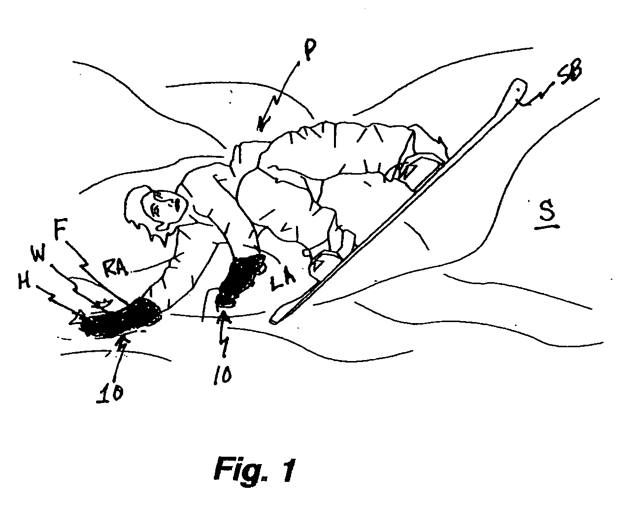 Forelimb brace device