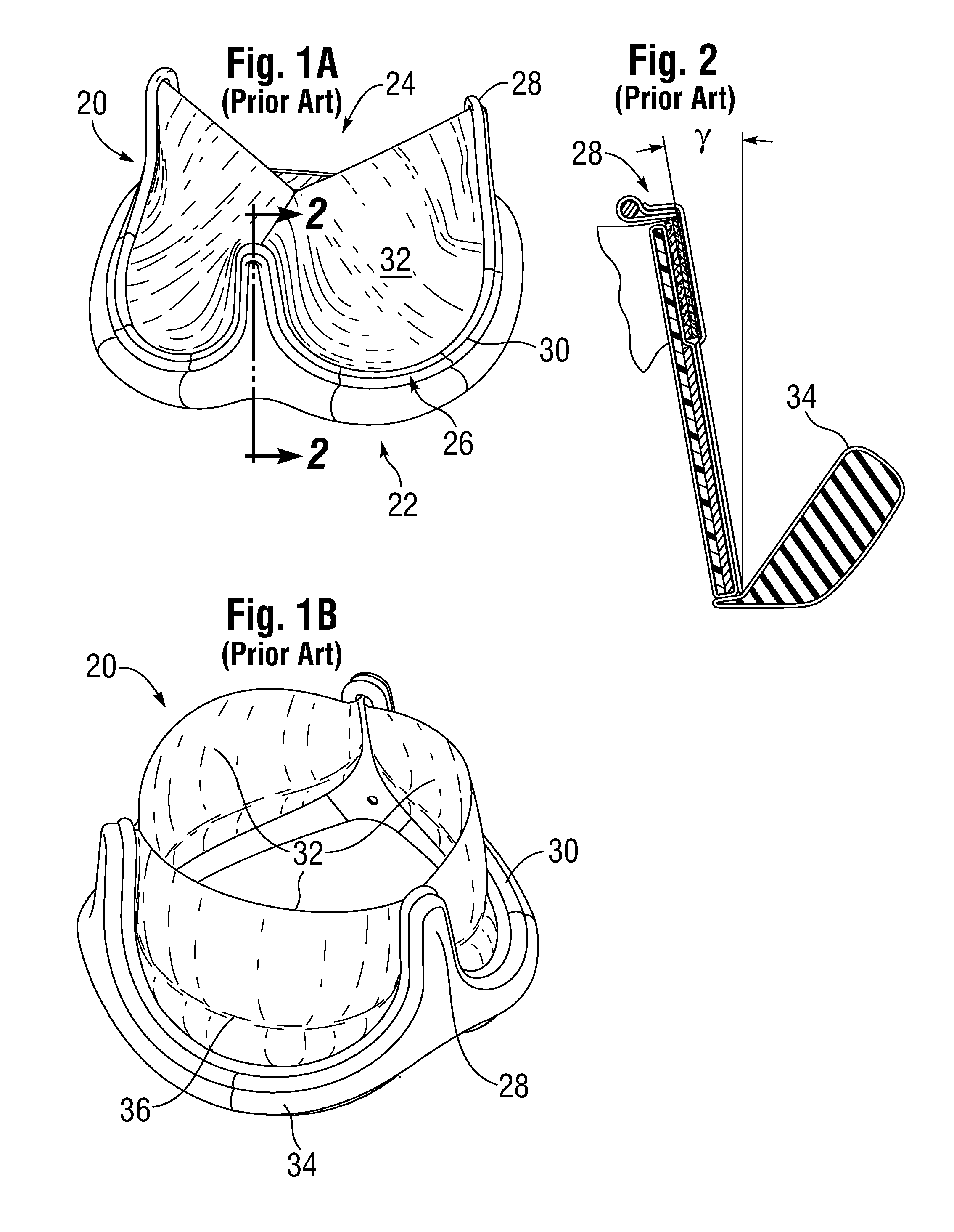 Low Gradient Prosthetic Heart Valve