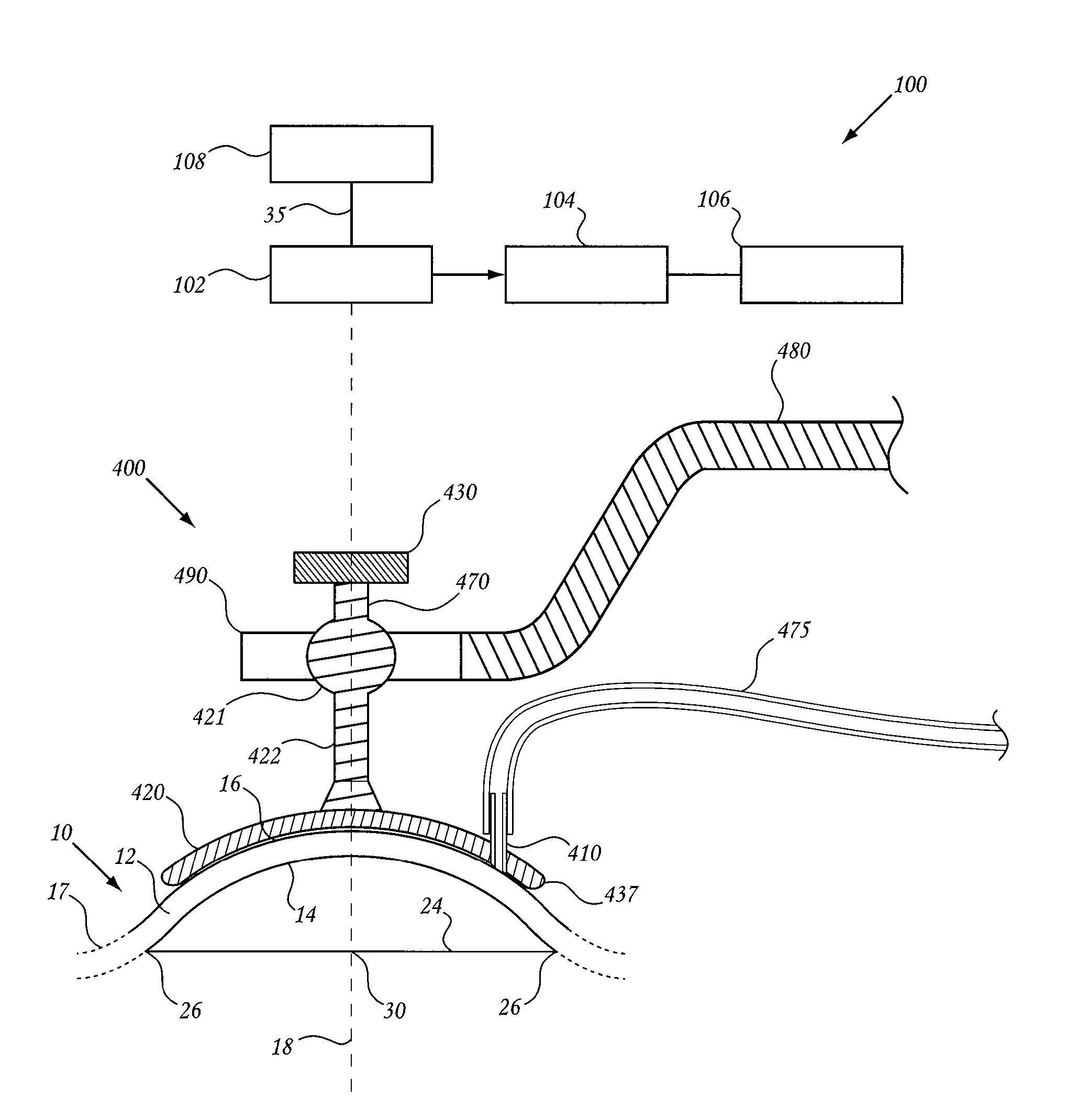 Method and device for ocular alignment and coupling of ocular structures