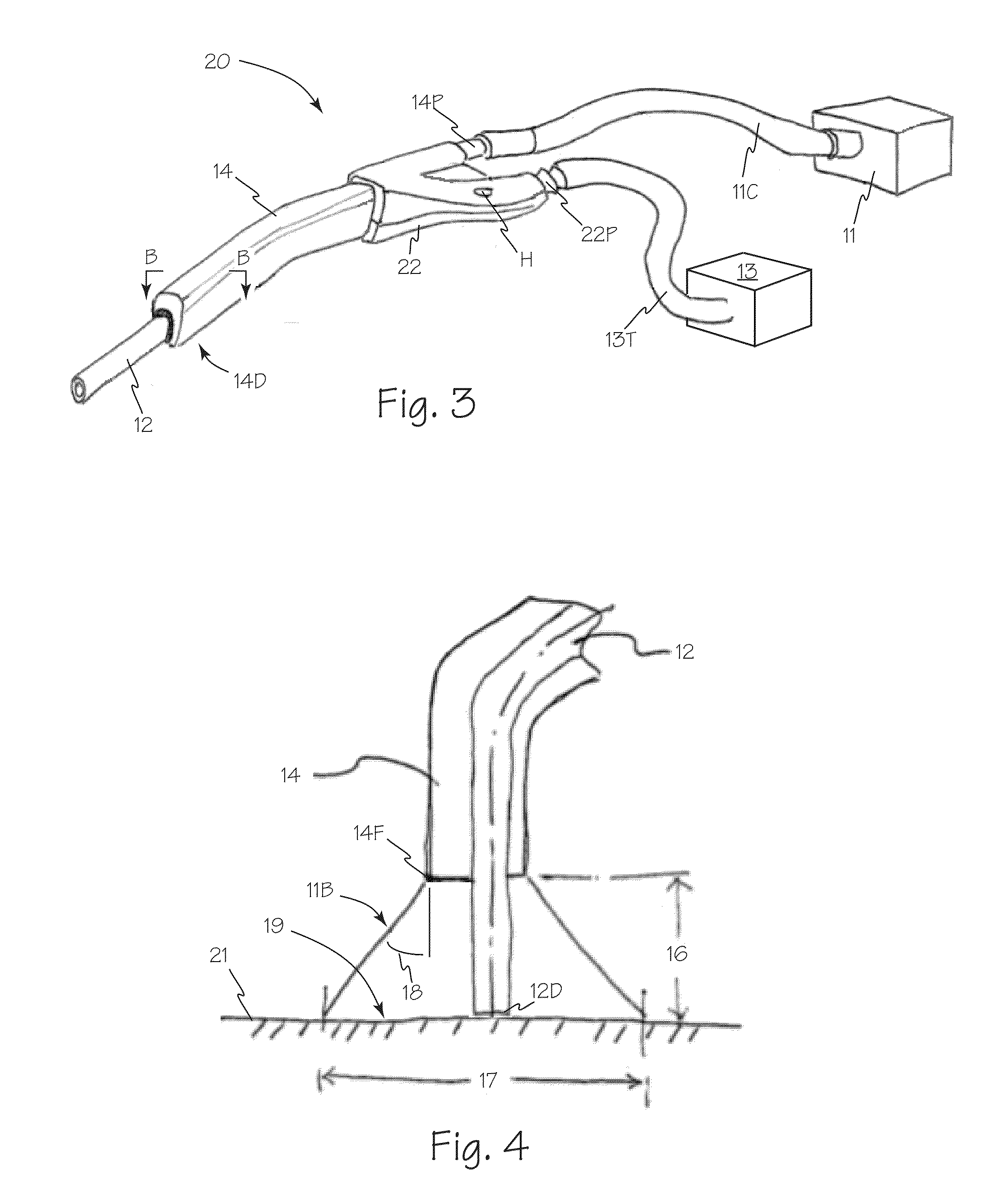 Illuminated Suction Apparatus