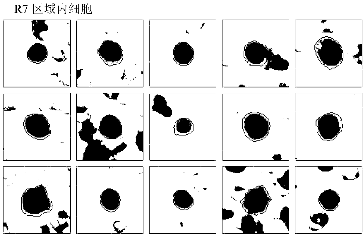 Method for differential counting of white blood cells based on morphology