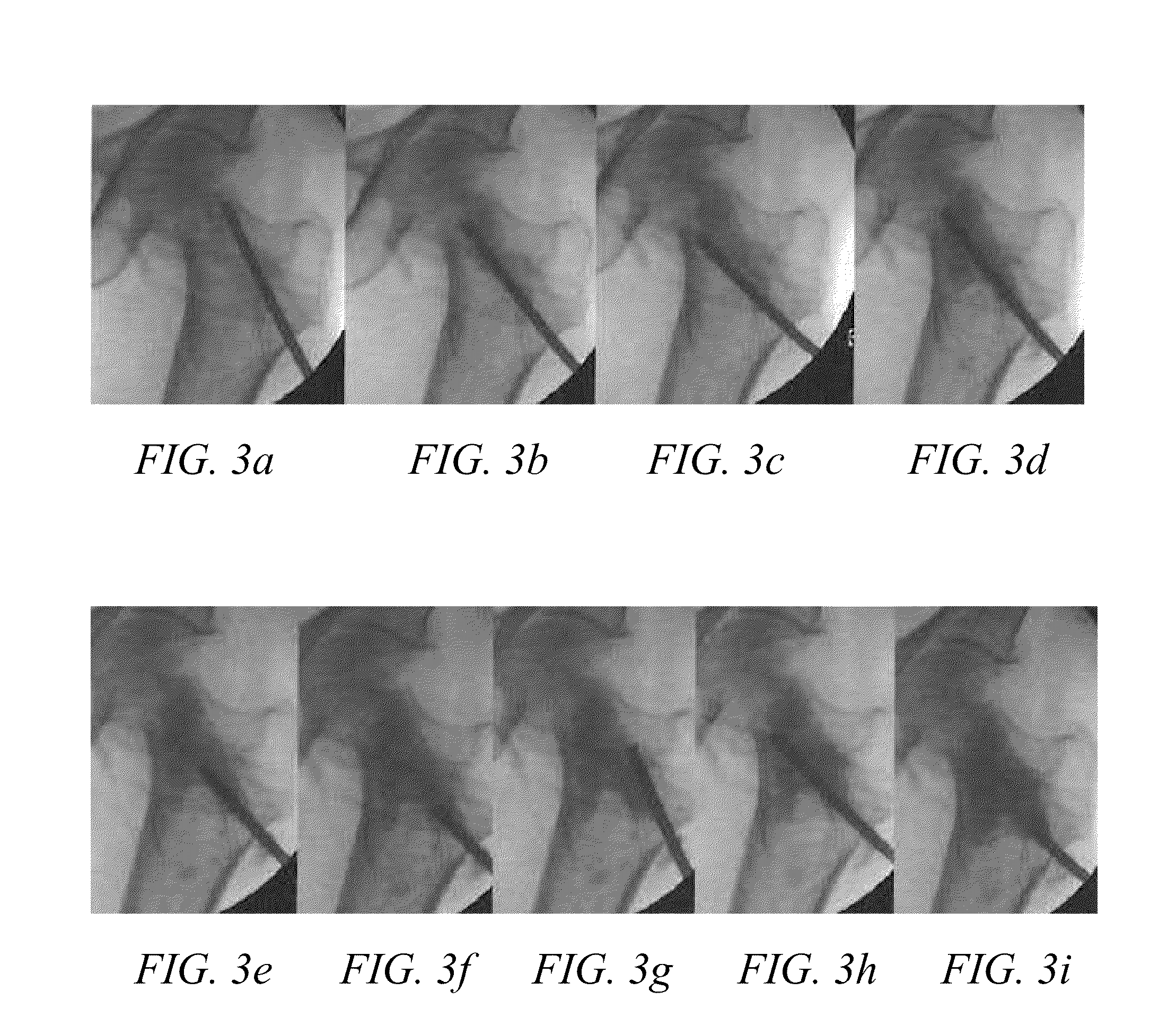 Methods of treating degenerative bone conditions