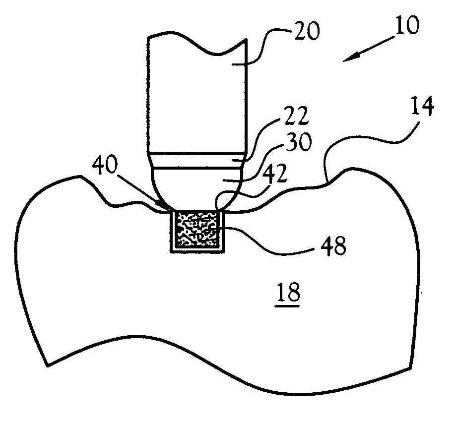 Universal depth cut burr having dental and skeletal applications