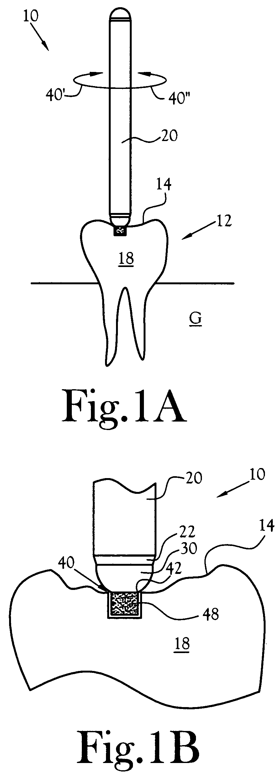 Universal depth cut burr having dental and skeletal applications