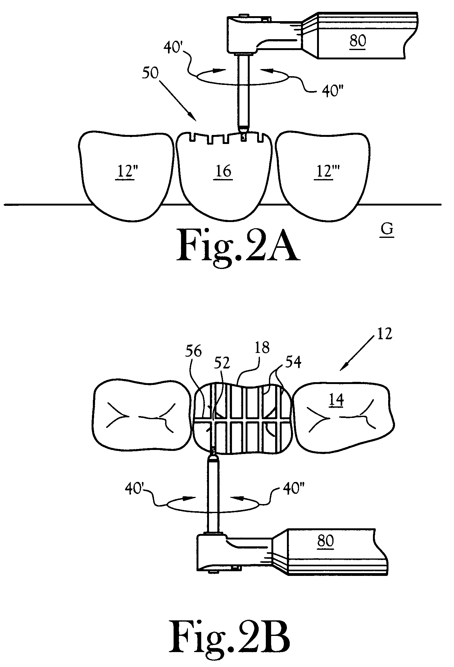 Universal depth cut burr having dental and skeletal applications