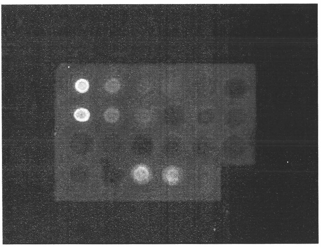 Preparation of multi-epitope TK1 antibody and application of multi-epitope TK1 antibody to evaluation on recurrence risk and prognosis of tumor patient at early stage