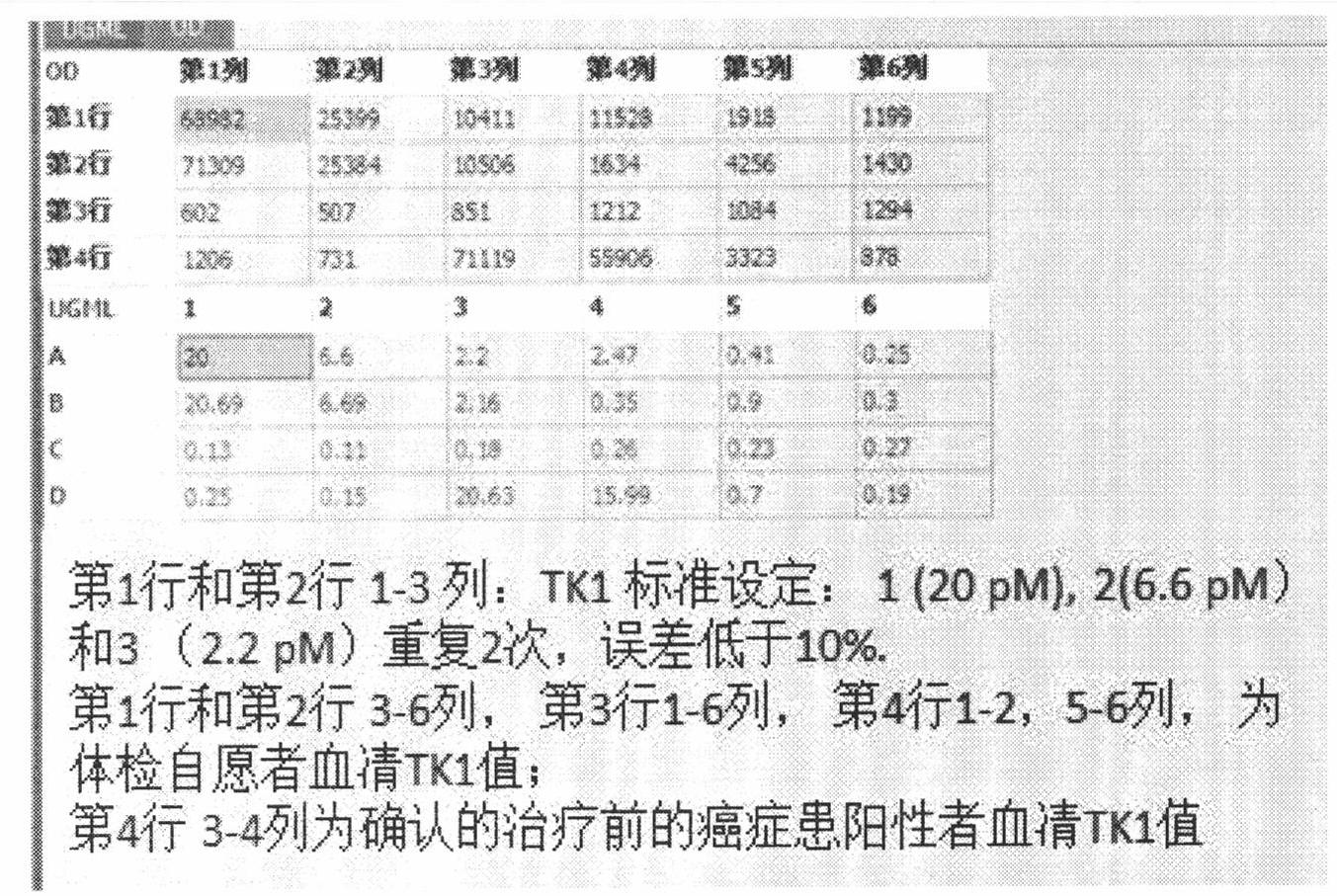 Preparation of multi-epitope TK1 antibody and application of multi-epitope TK1 antibody to evaluation on recurrence risk and prognosis of tumor patient at early stage