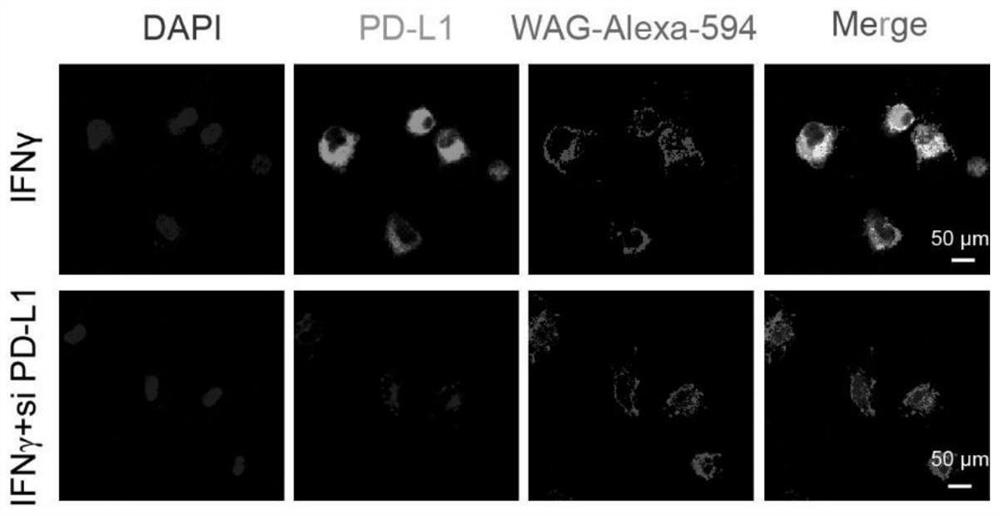 Genetically engineered antigen presenting extracellular vesicle as well as preparation method and application thereof