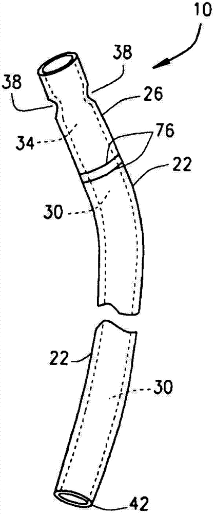 Device to assist delivery of fetal head at cesarean section