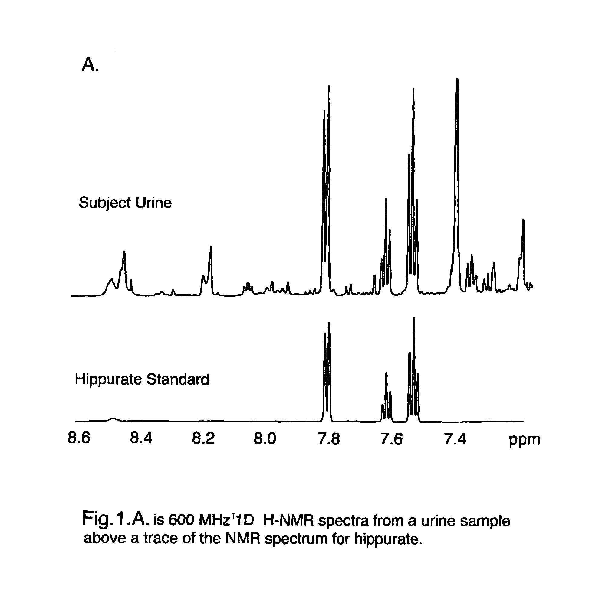 Method of diagnosing a respiratory disease