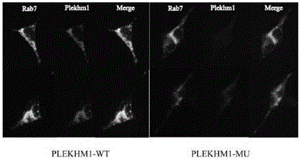 Novel mutant pathogenic gene PLEKHM1 of osteopetrosis, and encoded protein and application thereof