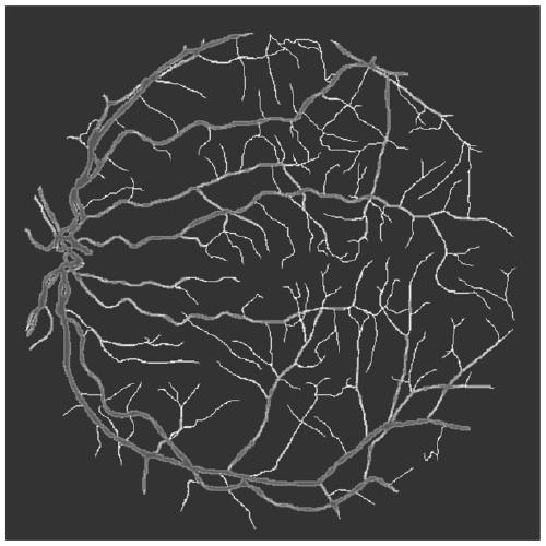 Fundus blood vessel segmentation method based on branch attention and multi-model fusion