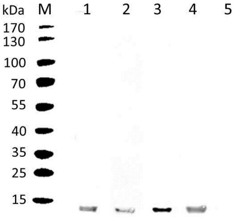 Gene highly expressed in schistosoma japonicum katsurada, and coding protein and application thereof