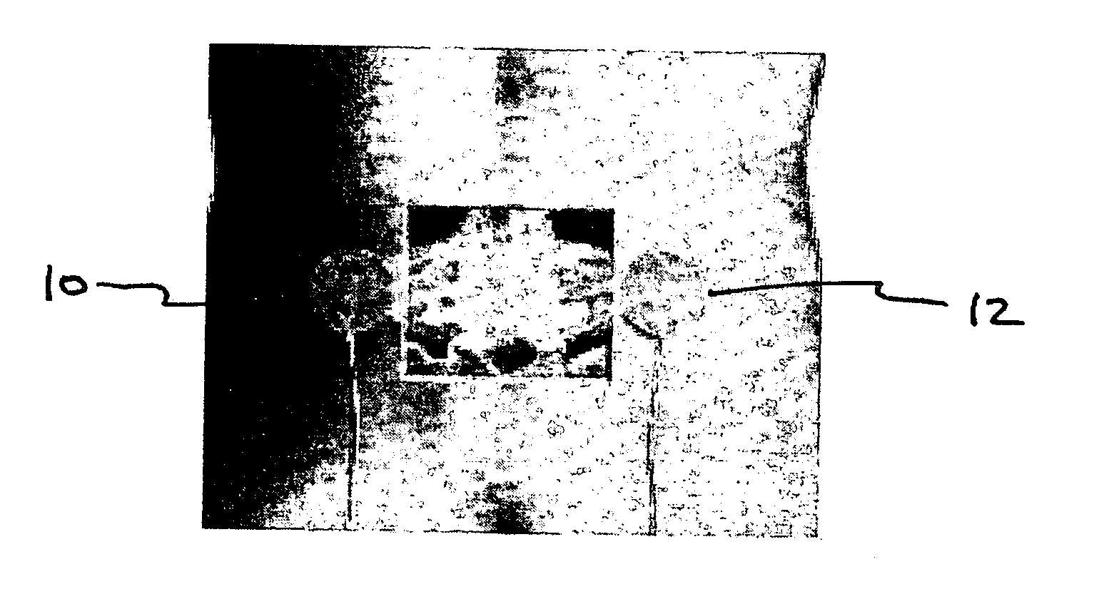 Method for treating degenerative disc disease using noninvasive capacitively coupled electrical stimulation device