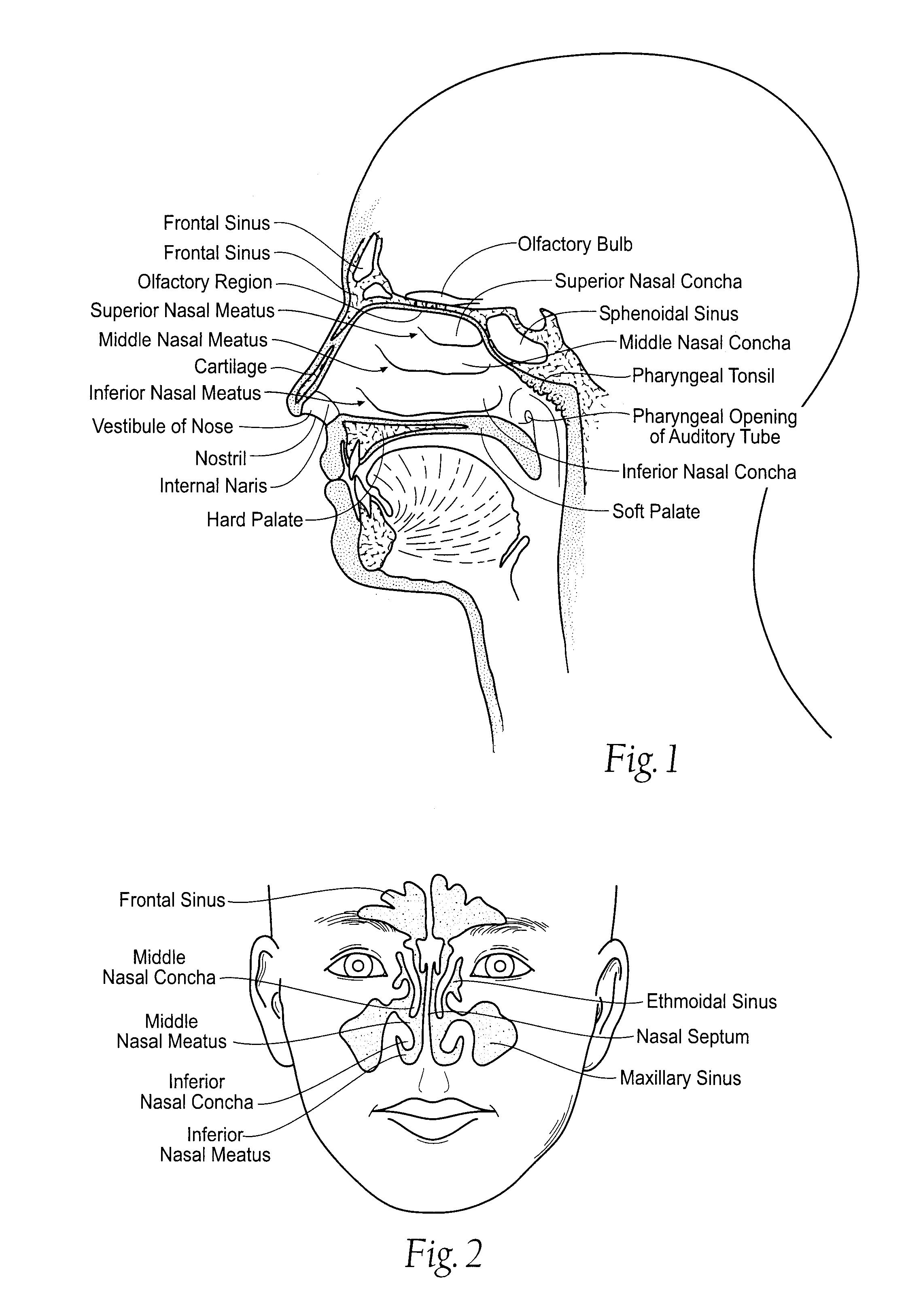 Irrigation and aspiration devices and methods