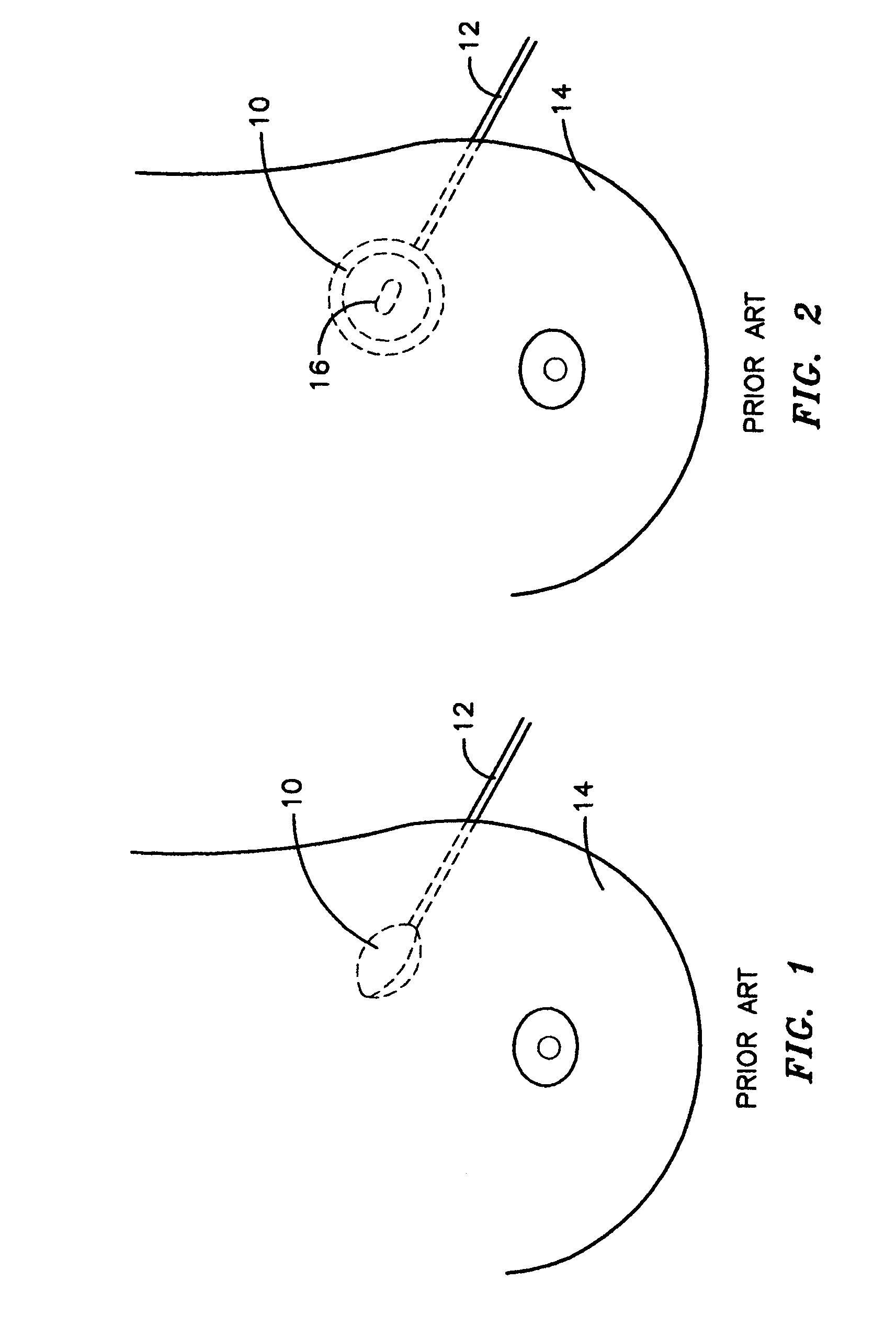 Imaging method for monitoring delivery of high dose rate brachytherapy