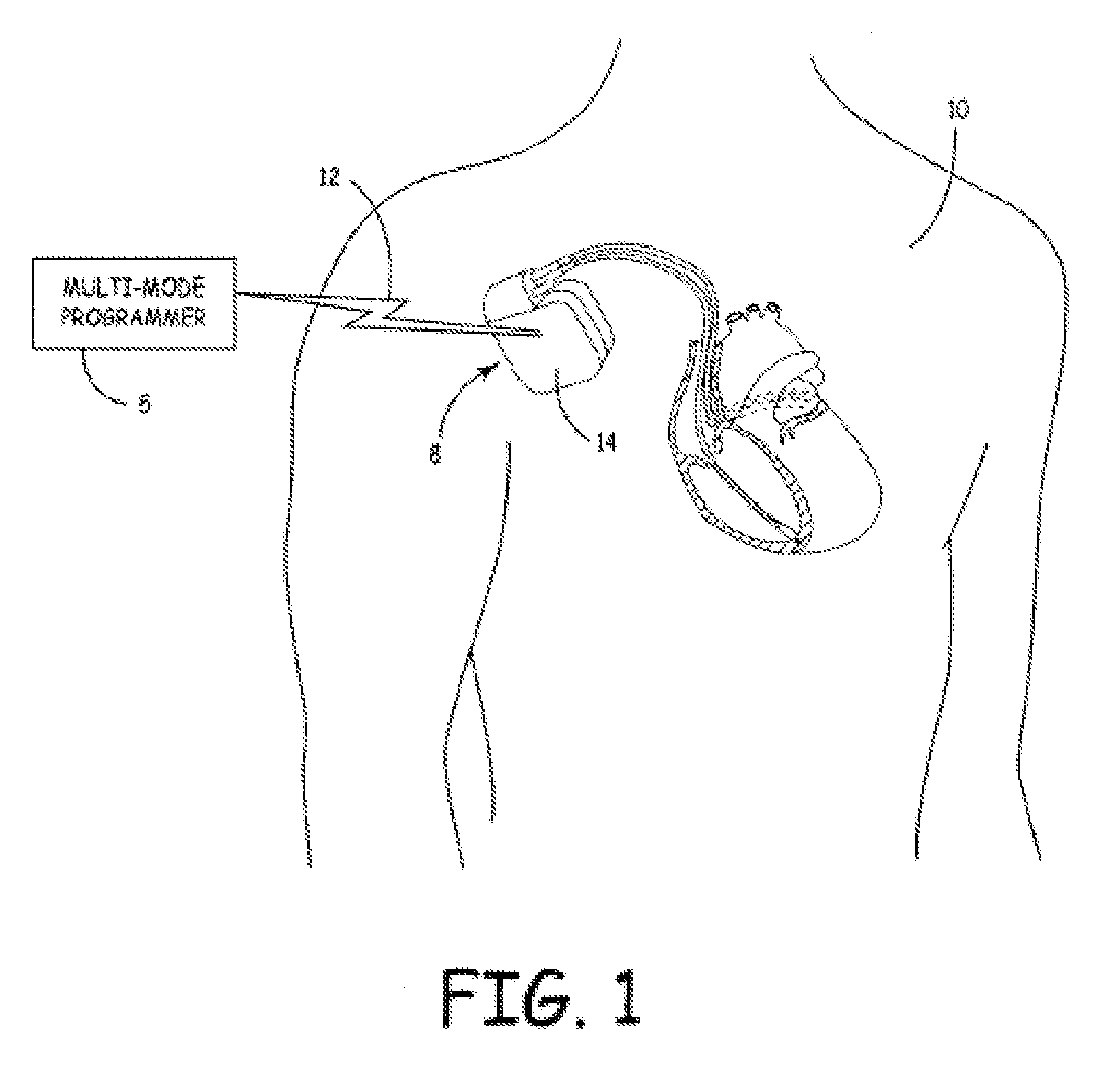 Multi-mode coordinator for medical device function