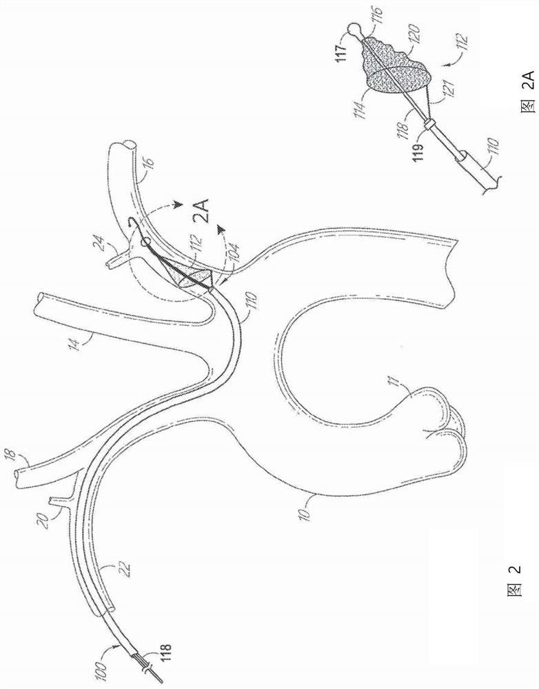 Systems for protecting the cerebral vasculature