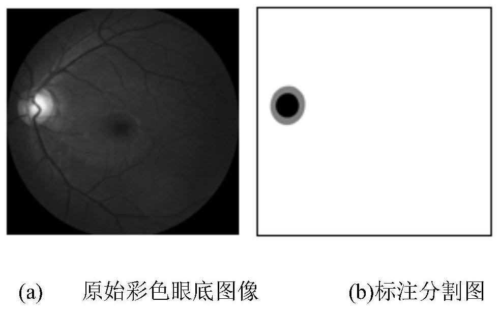 Fundus image optic cup and optic disk segmentation method