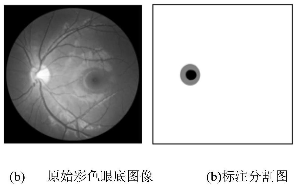 Fundus image optic cup and optic disk segmentation method