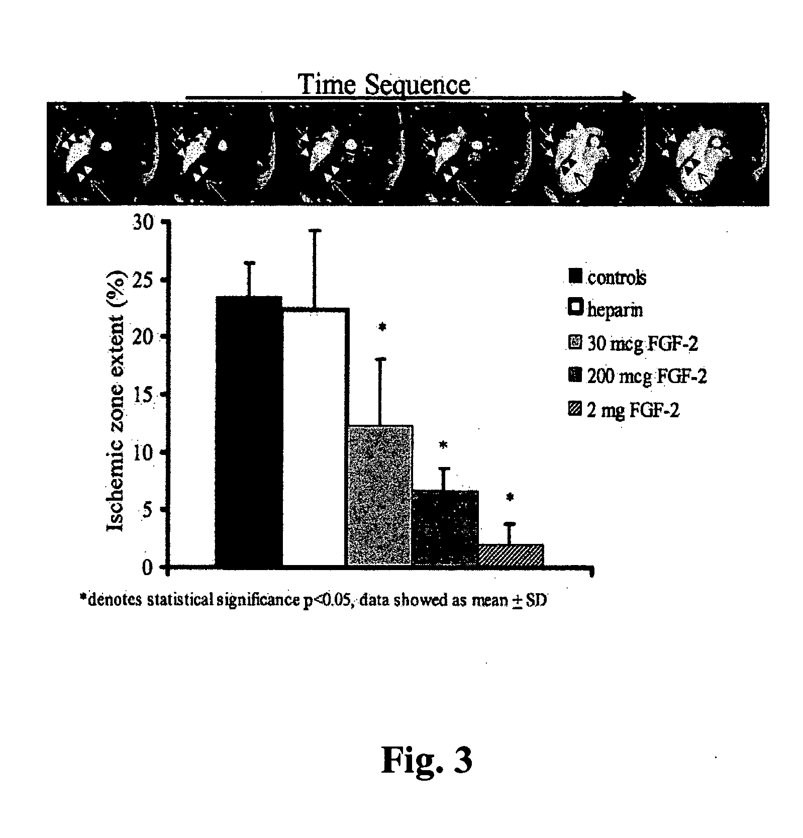 Growth factor therapy mobilization of stem cells into the peripheral blood