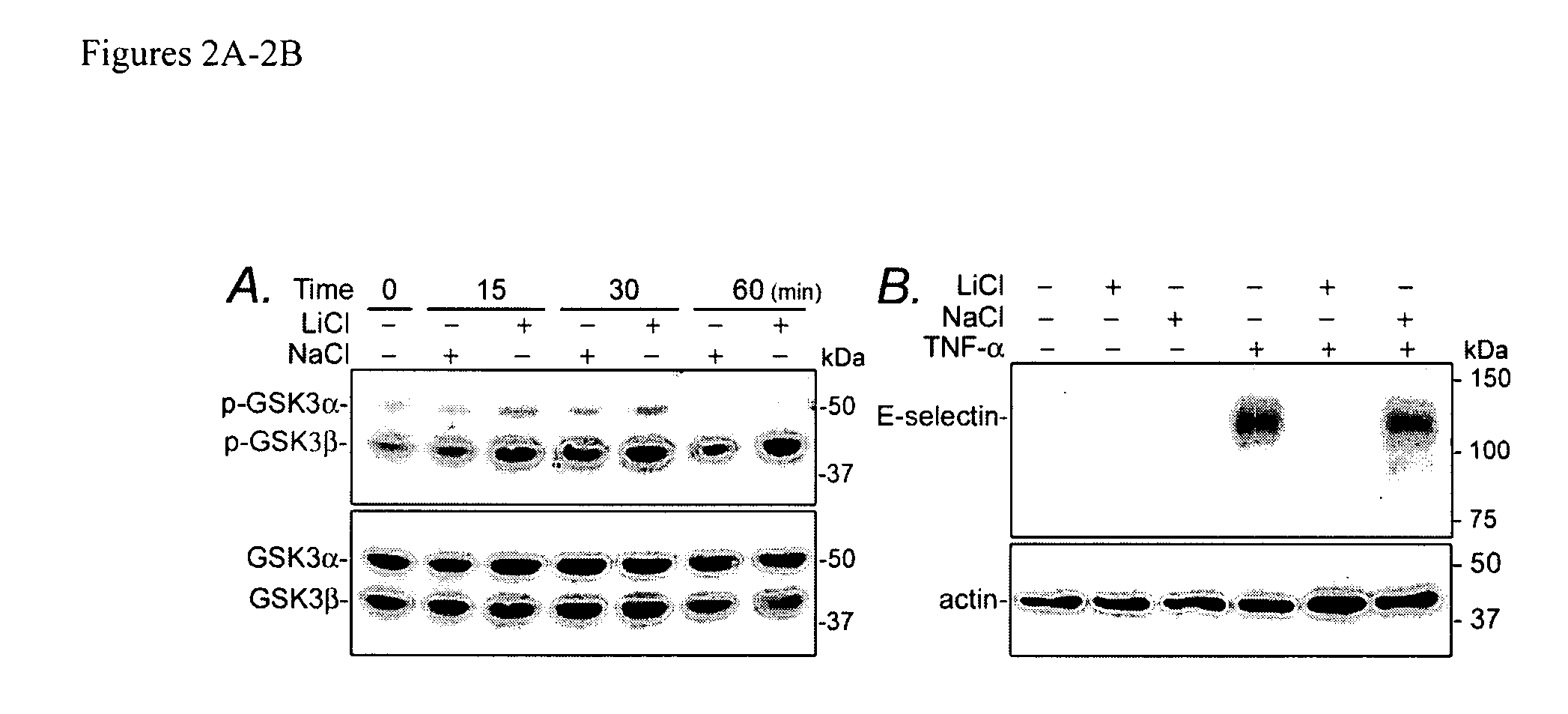 Compositions and methods for detecting and treating renal injury and inflammation