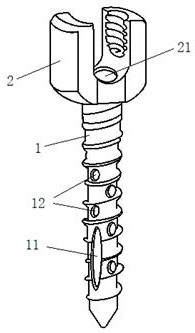 Percutaneous support-dilated bone-scraped vertebral body shaping device