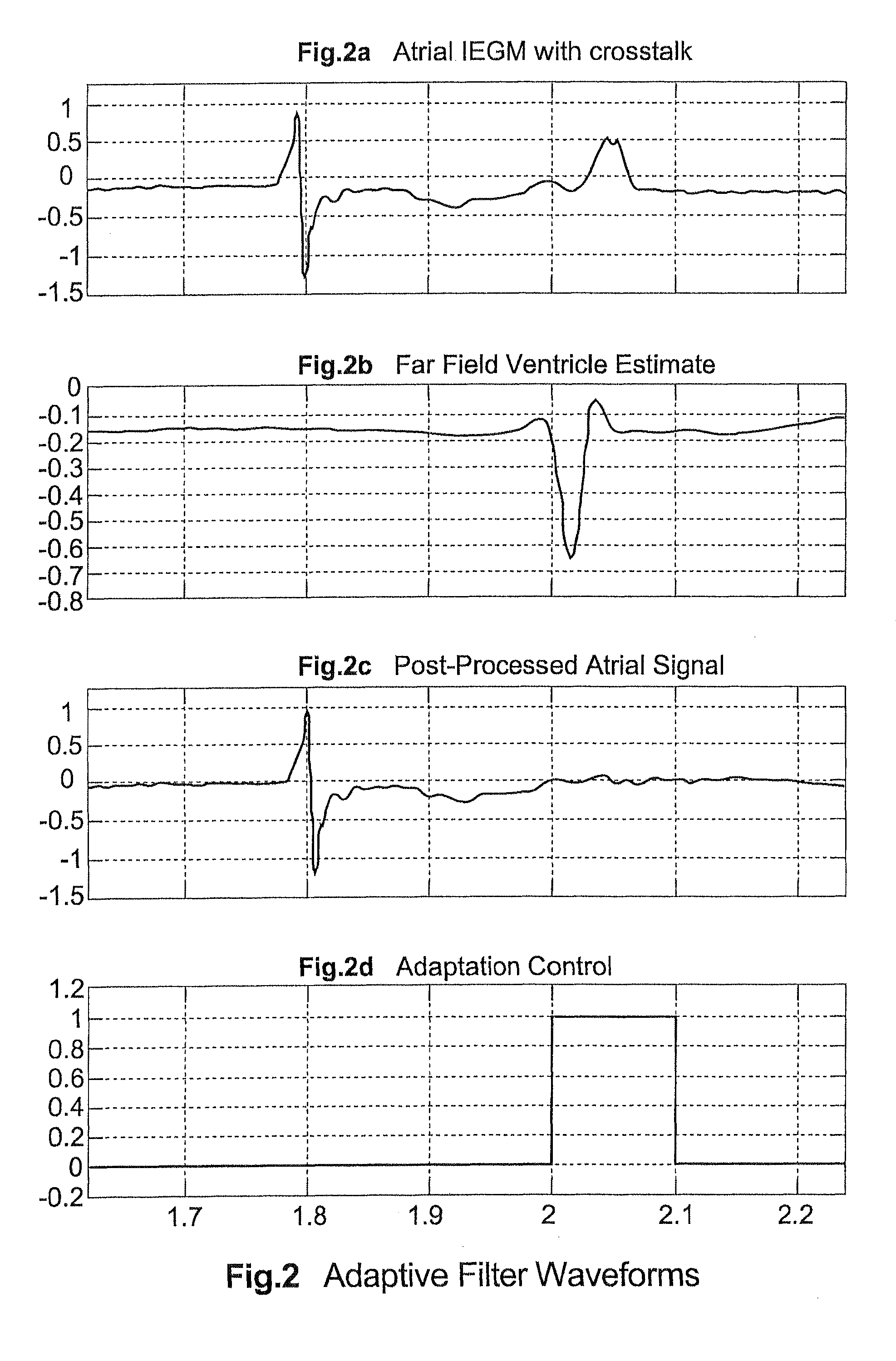 Method and apparatus for reducing far-field interchamber interference in an implanted medical device