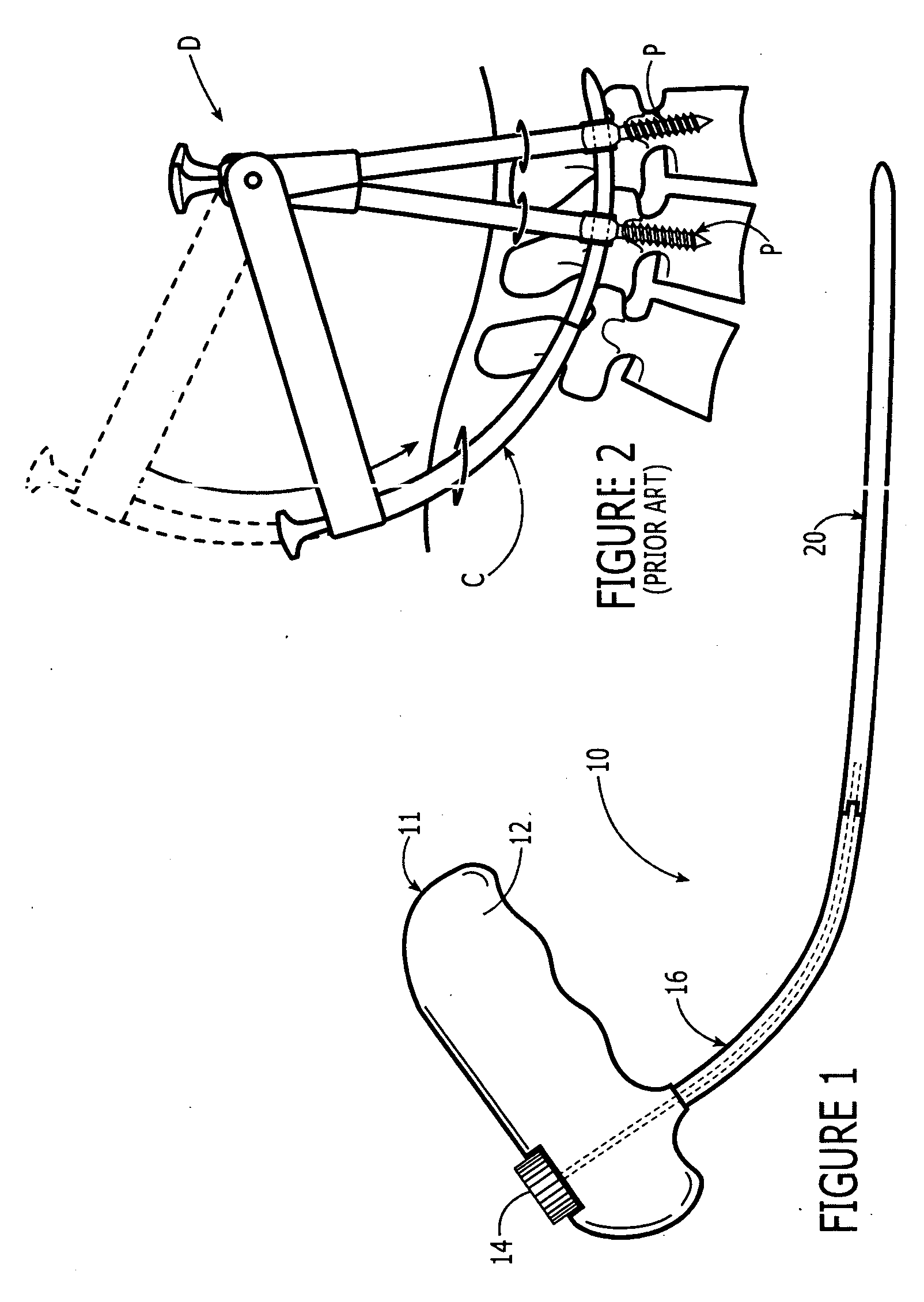 Rod delivery device and method