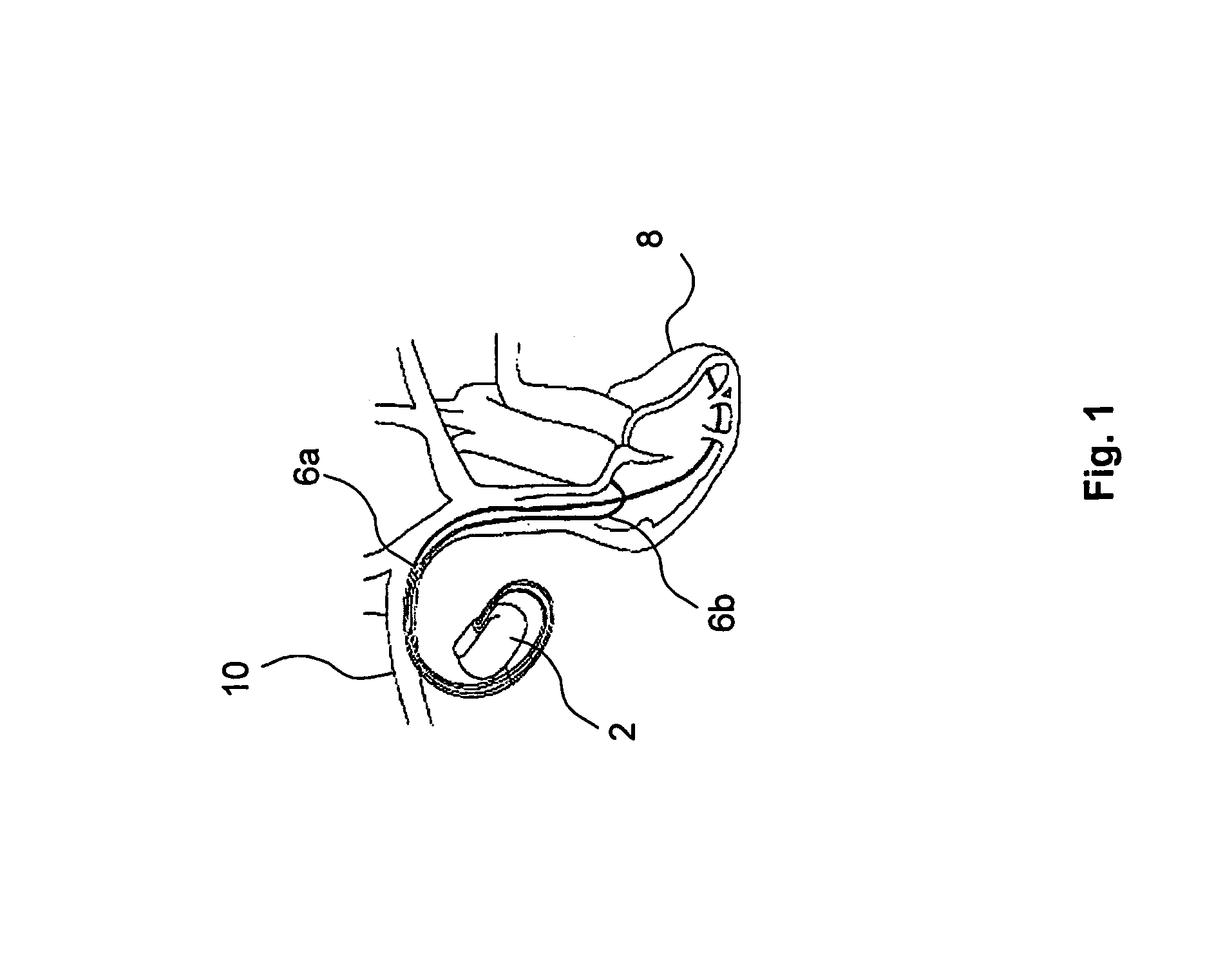 Implantable medical device with therapy control