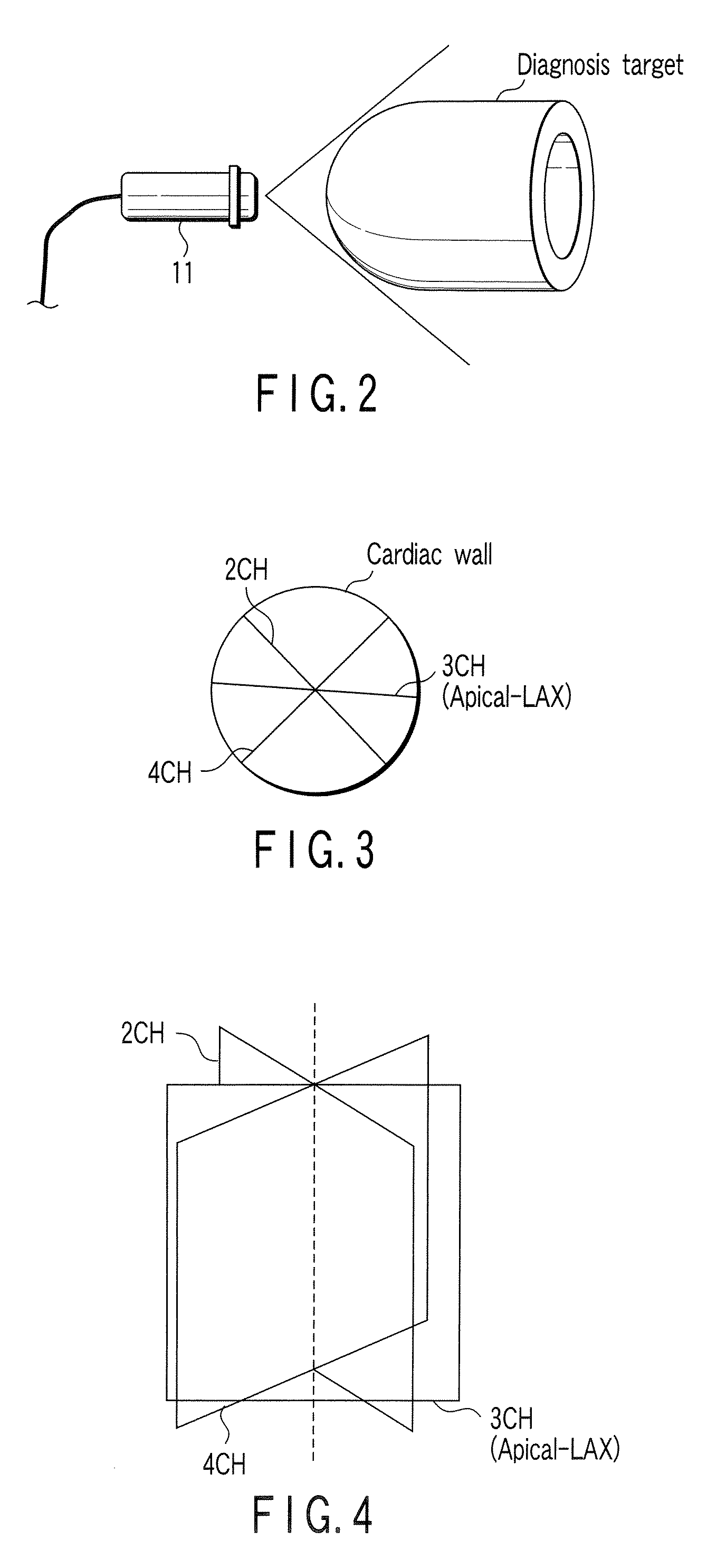 Ultrasonic image processing apparatus, ultrasonic diagnostic apparatus, and ultrasonic image processing program