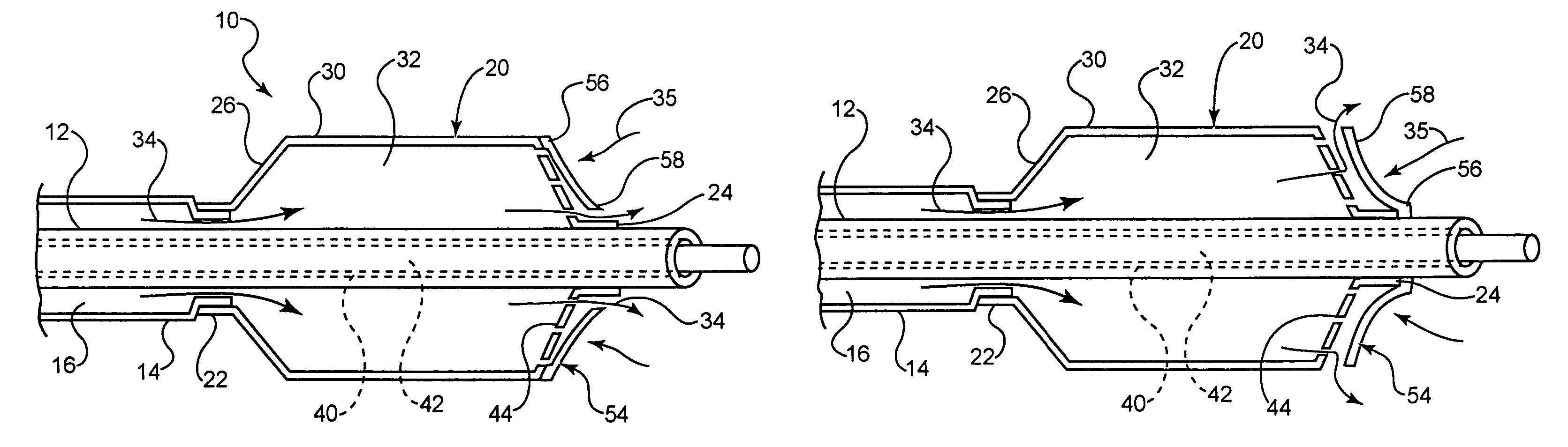 Intravascular dilatation infusion catheter