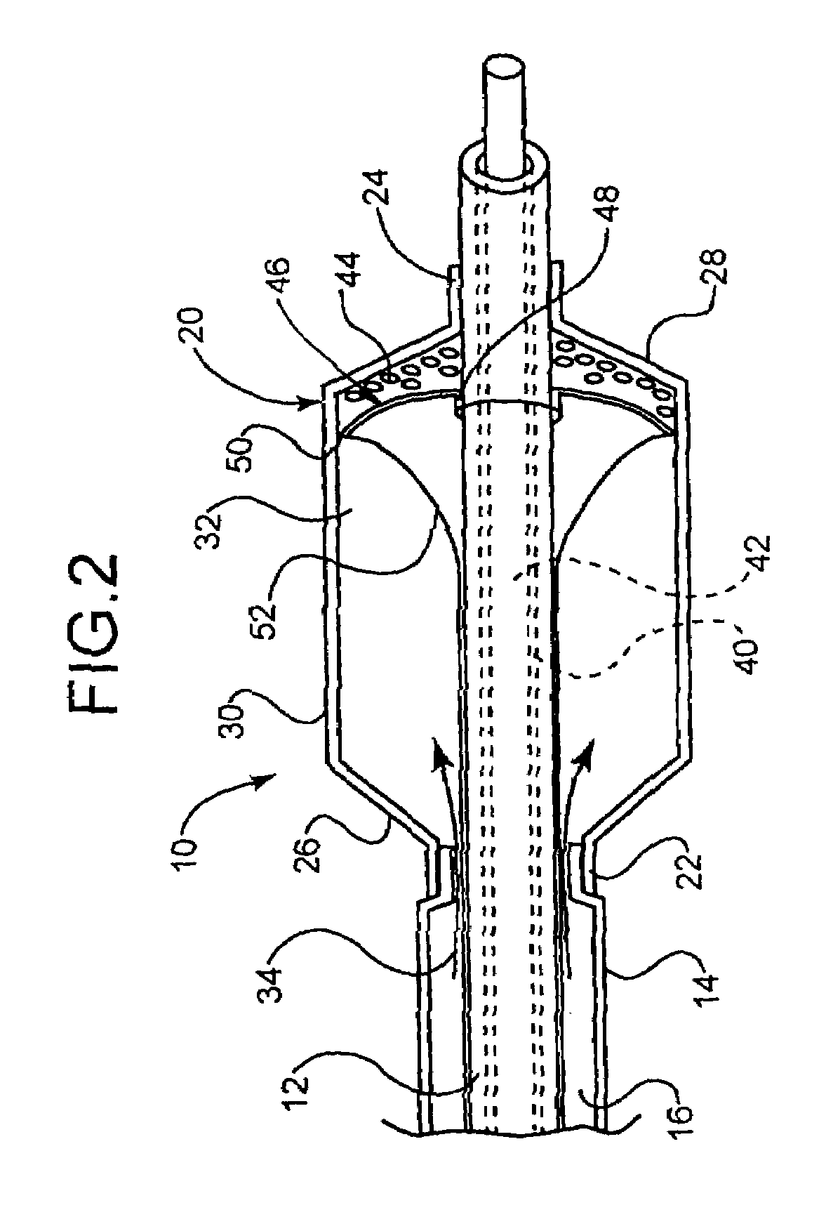 Intravascular dilatation infusion catheter