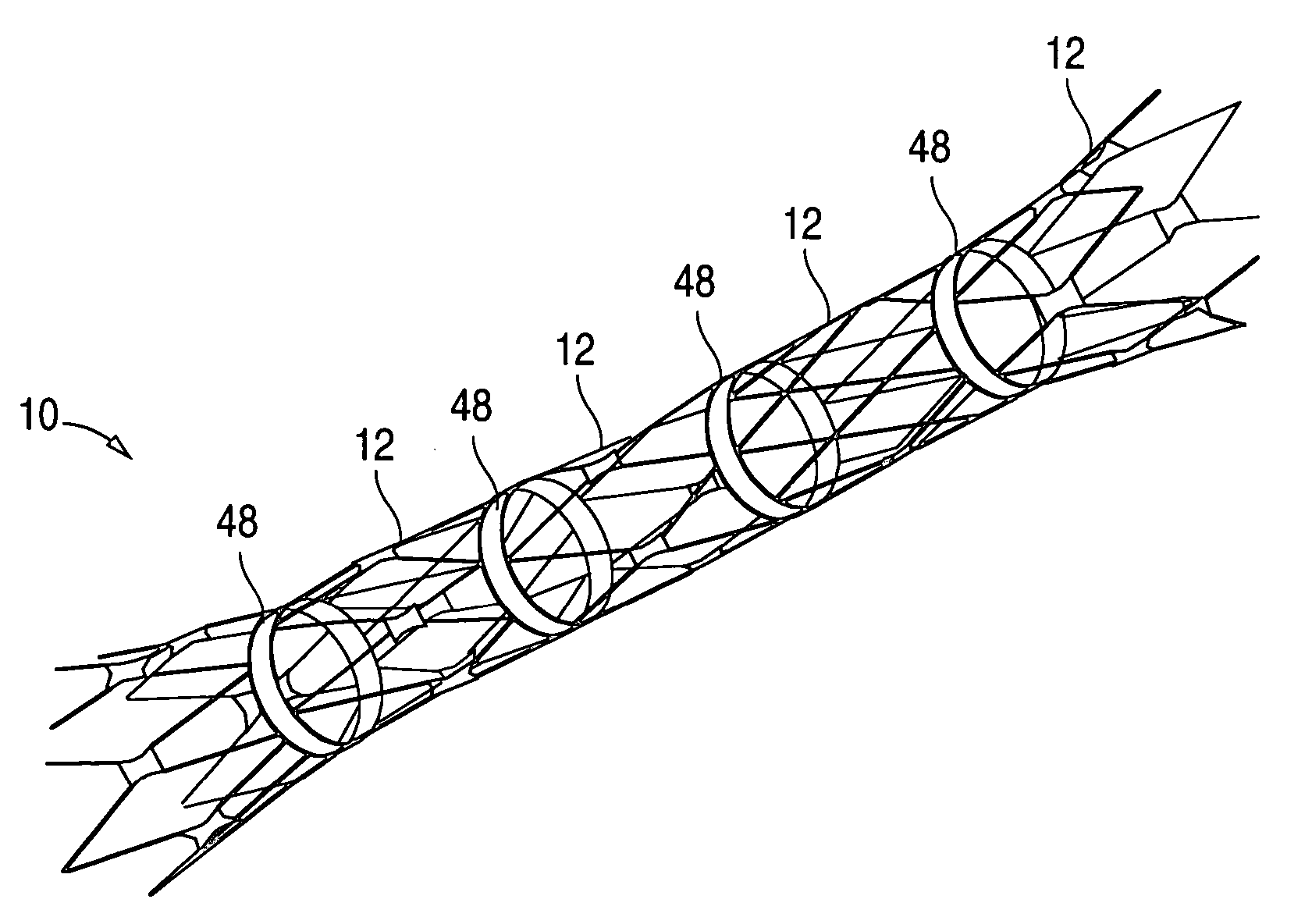 Flexible stent and method of making the same