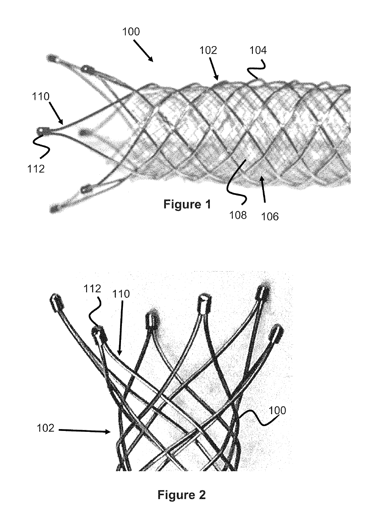 Vessel prosthesis