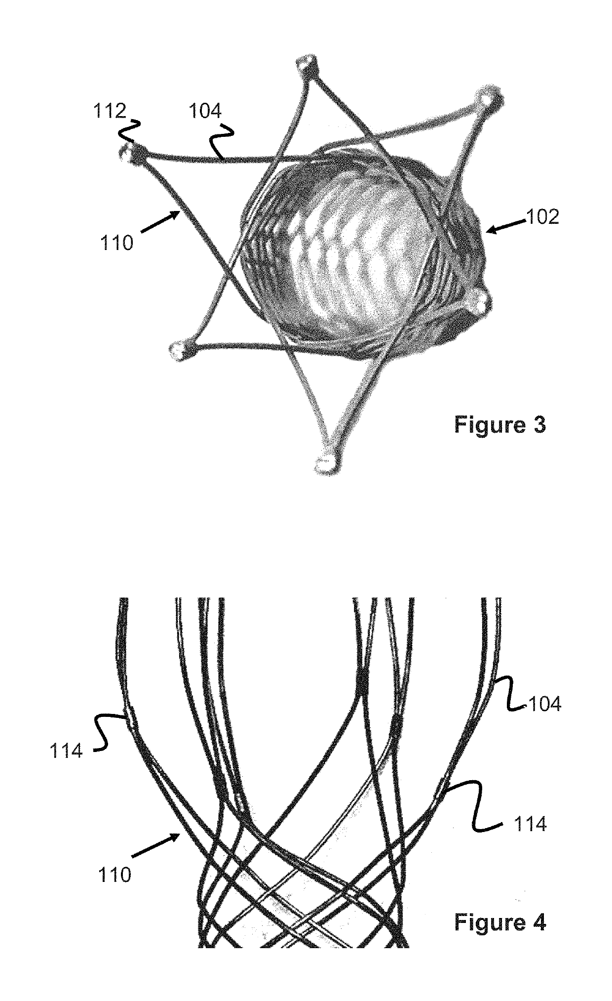 Vessel prosthesis