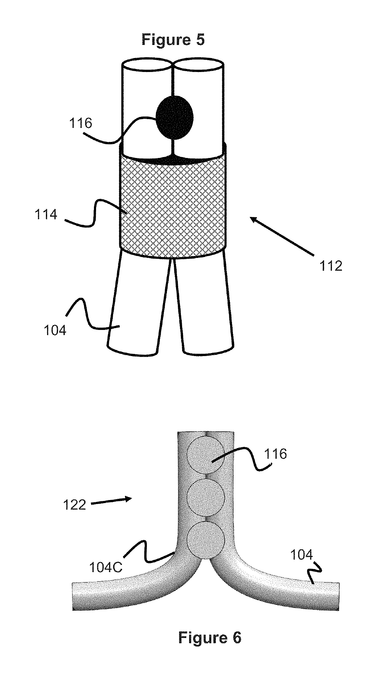 Vessel prosthesis