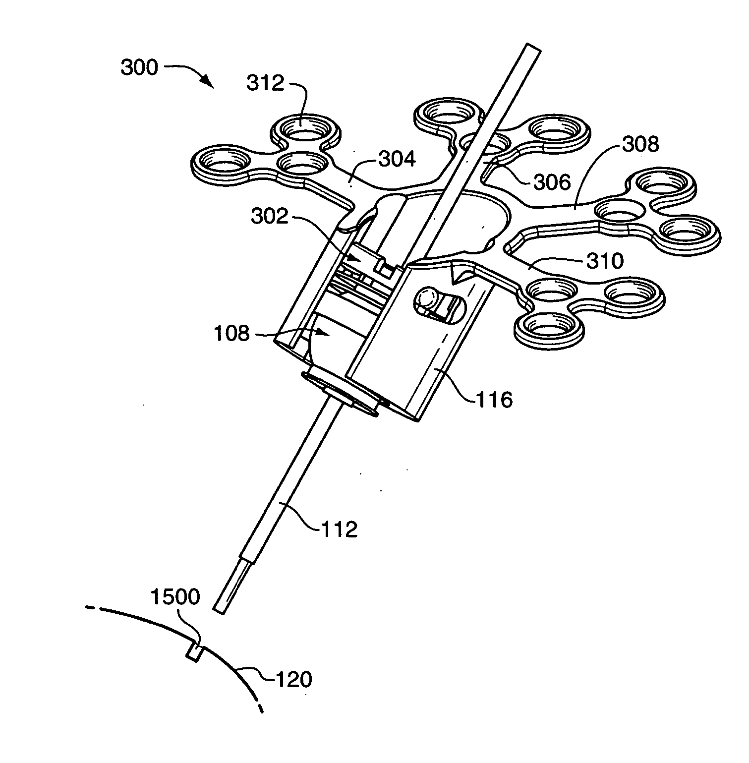 Implantable hearing aid transducer system