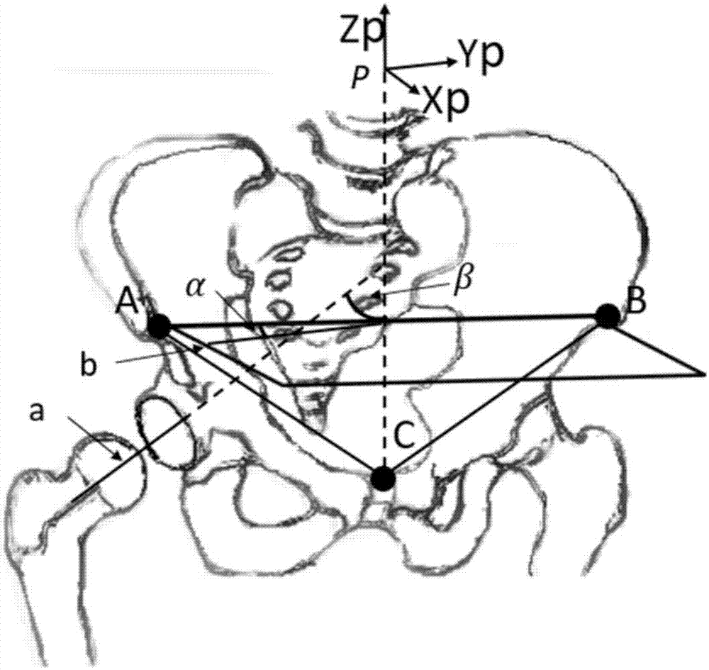 Method and system for obtaining pelvic posture and prosthesis installation angle in total hip replacement surgery