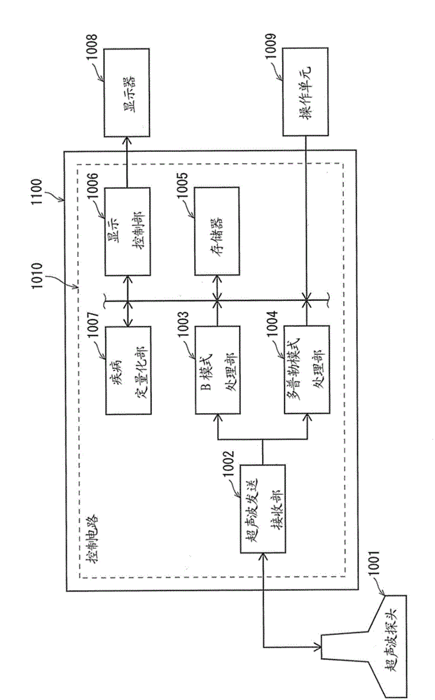 Ultrasound diagnostic apparatus and ultrasound image processing method