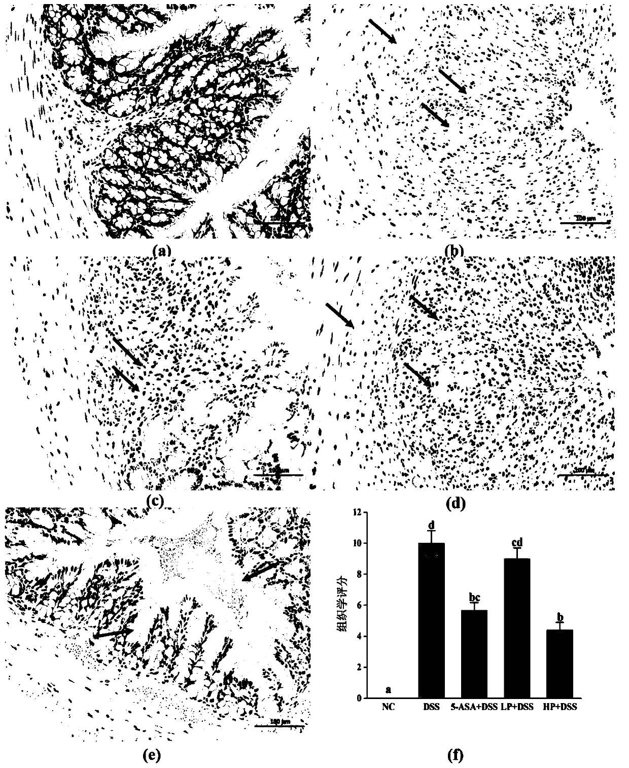 Application of litchi pulp polyphenol QRR and composition thereof in preparation of intestinal microecological preparation