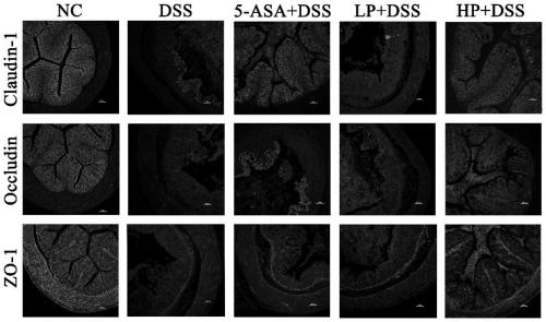 Application of litchi pulp polyphenol QRR and composition thereof in preparation of intestinal microecological preparation