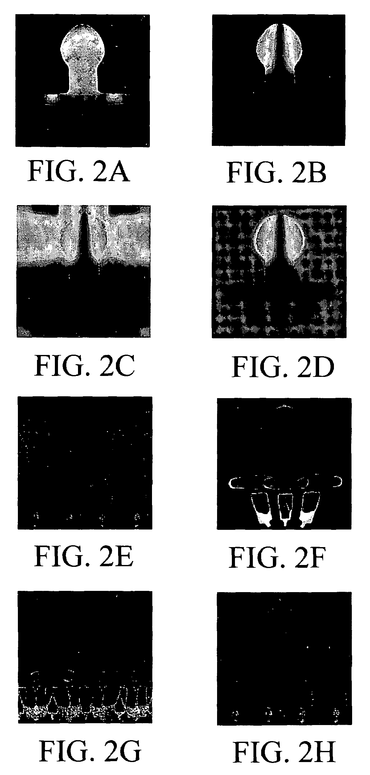 Method for applying an in-painting technique to correct images in parallel imaging