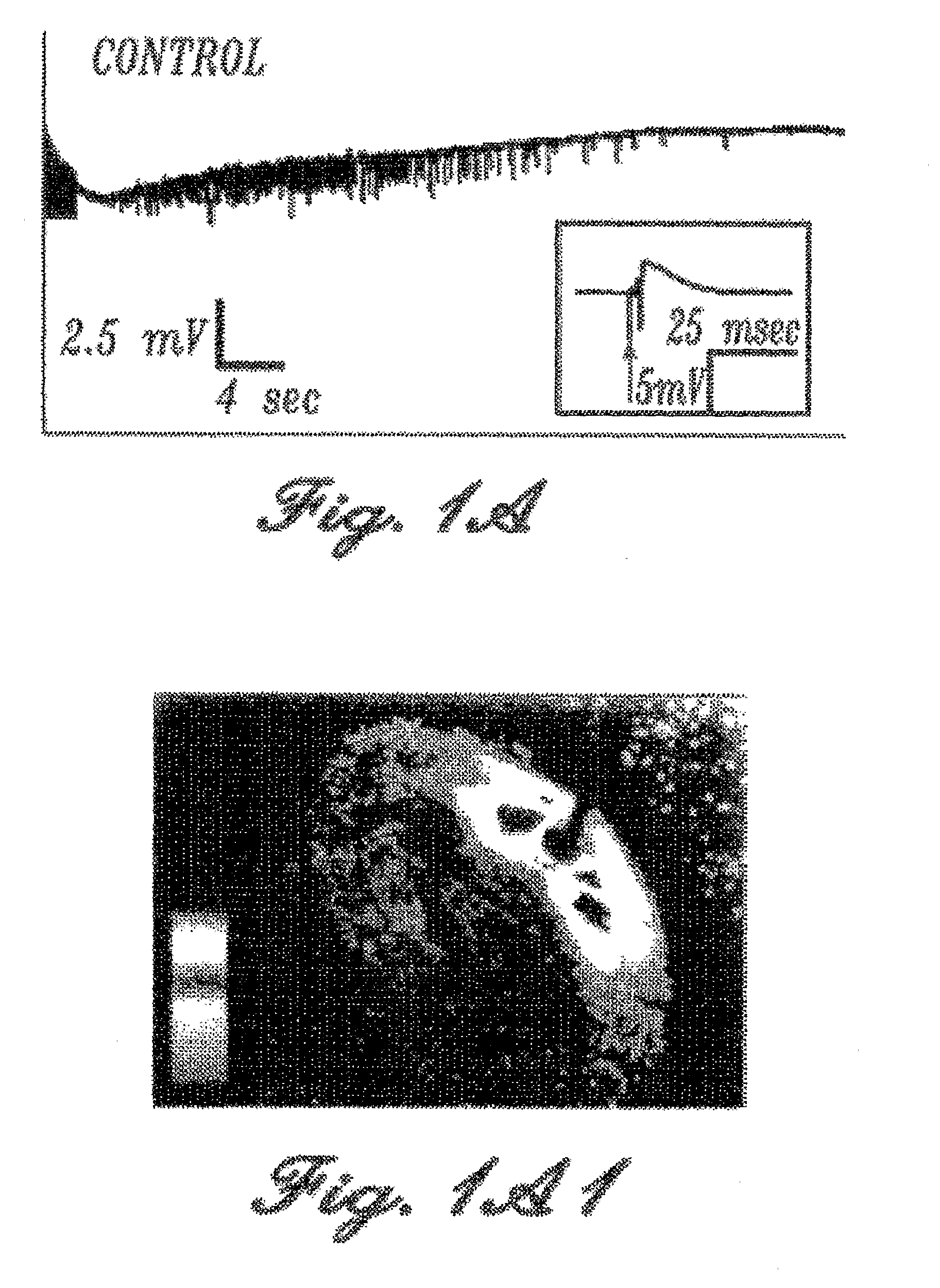 Methods and compositions for the treatment of neuropsychiatric and addictive disorders