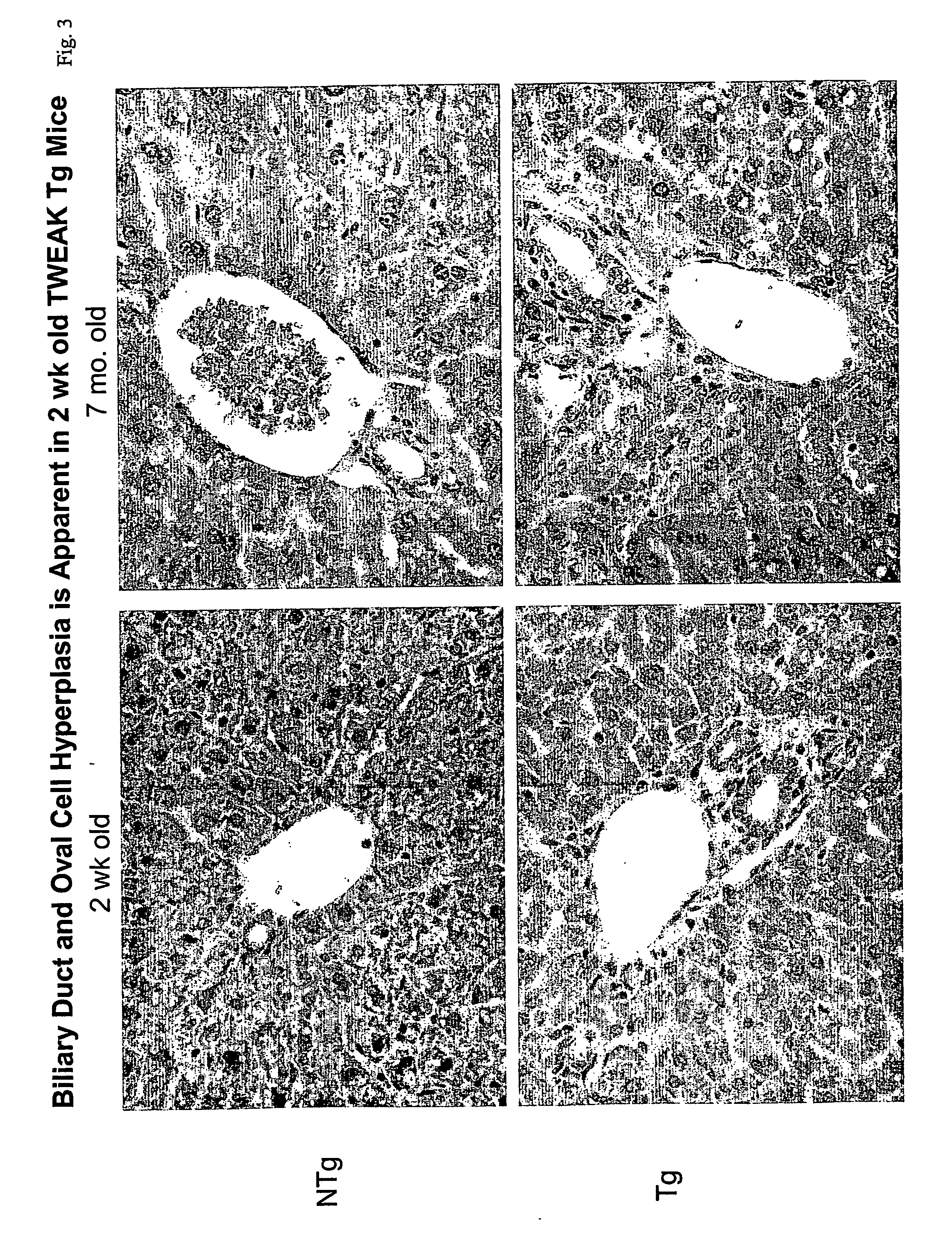 Methods for treating tweak-related conditions