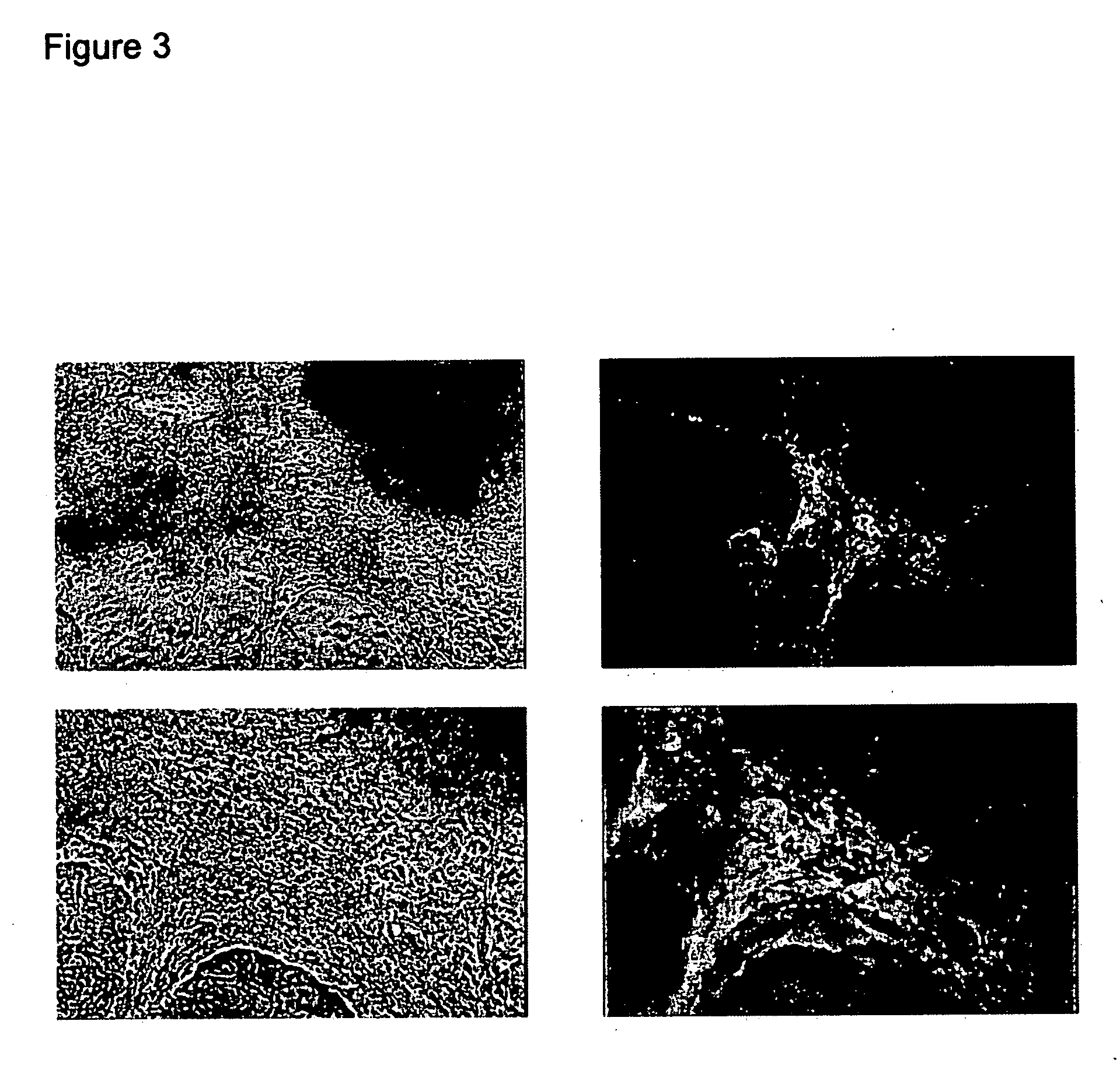 Differentiated cells suitable for human therapy