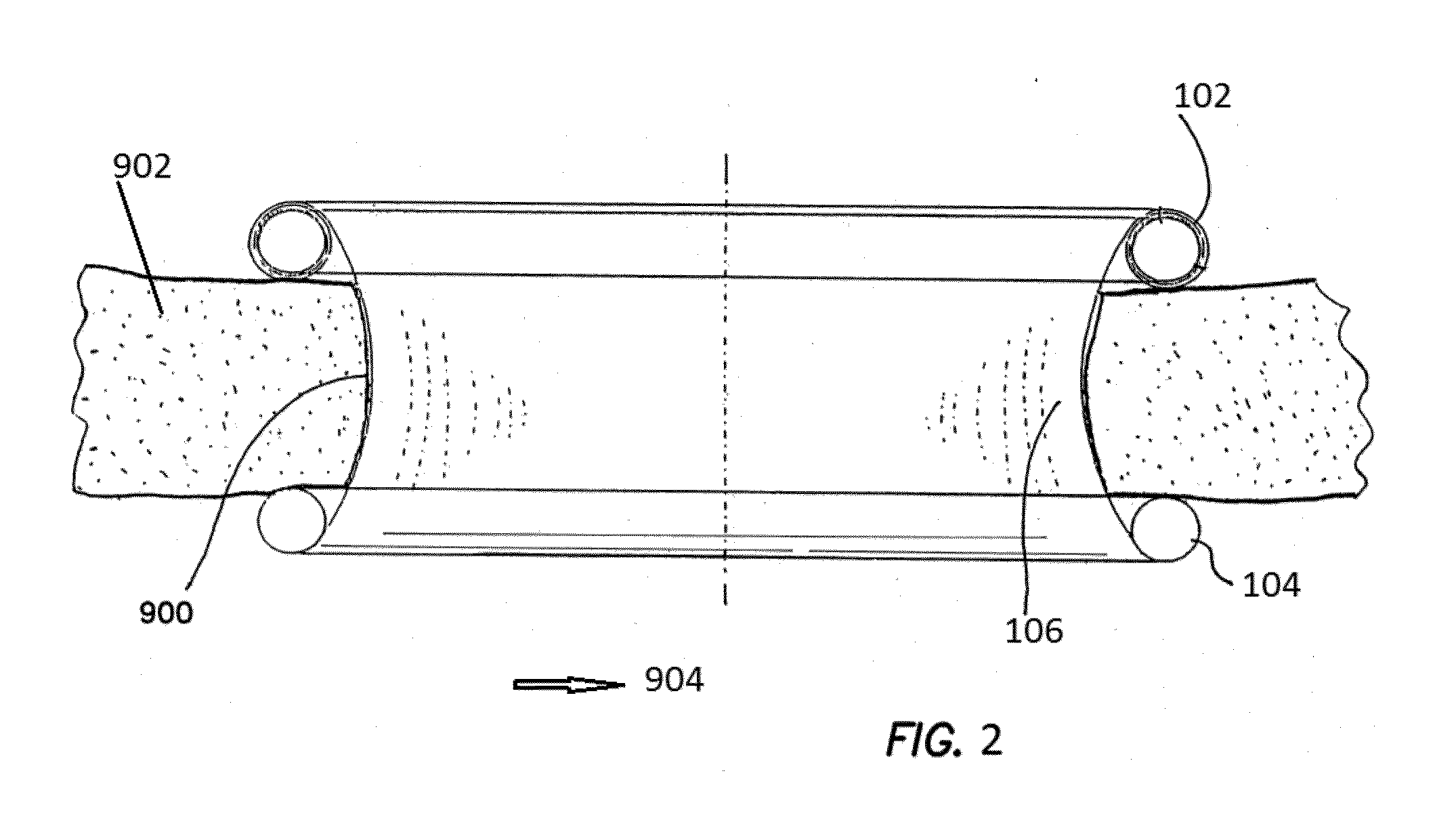 Wound retractor