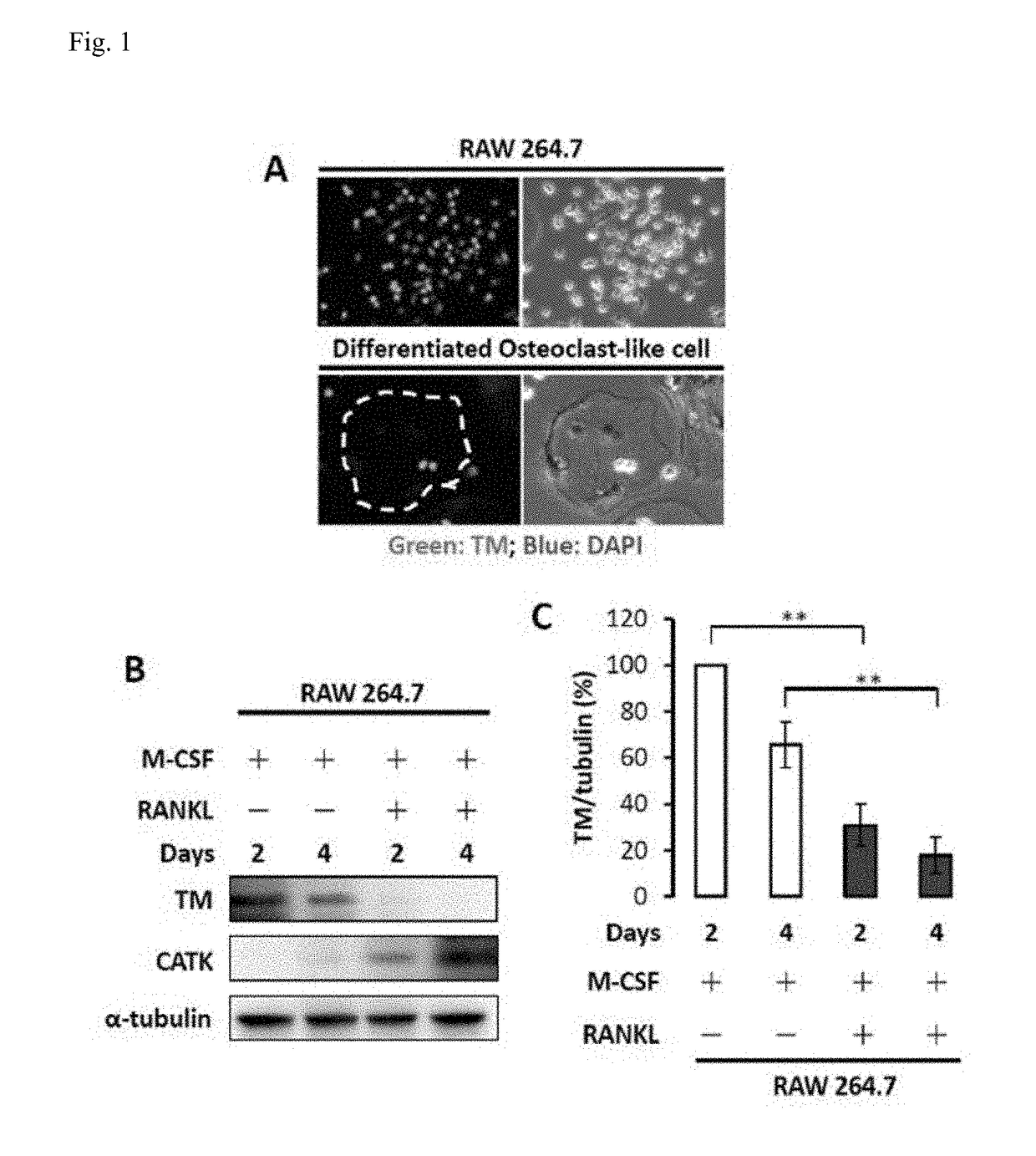 Tmd1 protein for treating bone loss diseases