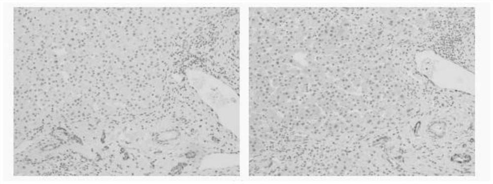 Anti-Calponin protein monoclonal antibody and cell strain, preparation method and application thereof