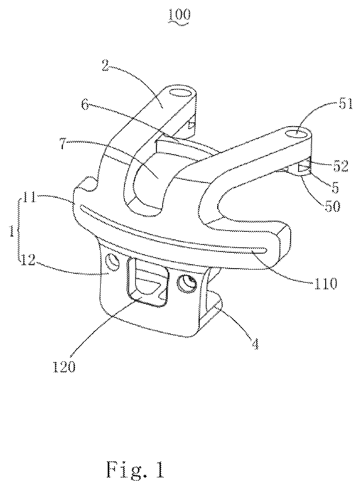 Customized surgical cutting guide for total knee replacement and method for making thereof